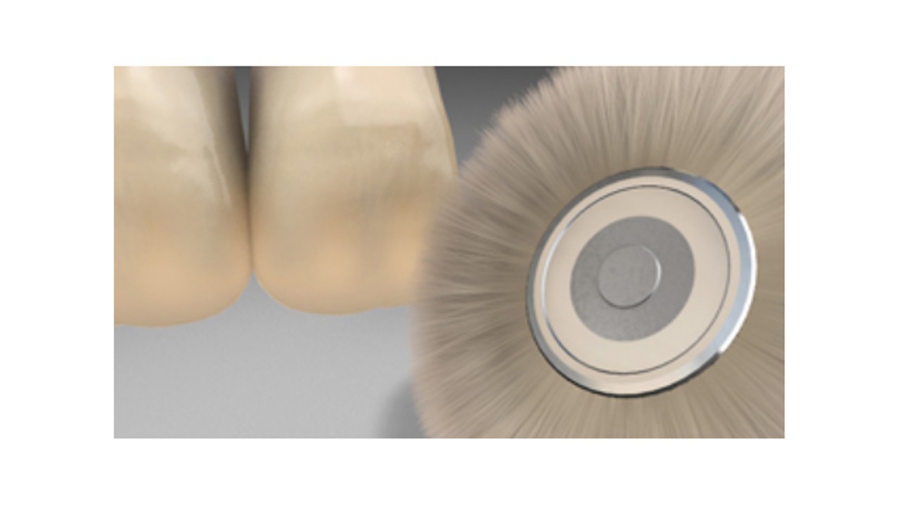 Βοηθήματα συστήματος ρητινών επικάλυψης σκελετών