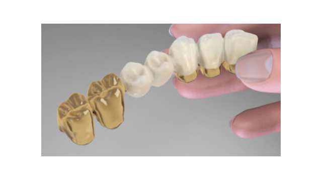 Στεφάνες και Γέφυρες