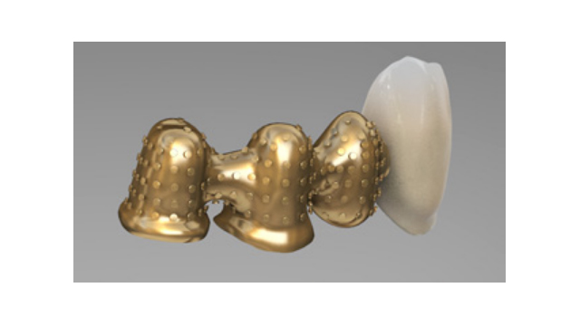 Metal-supported Veneering