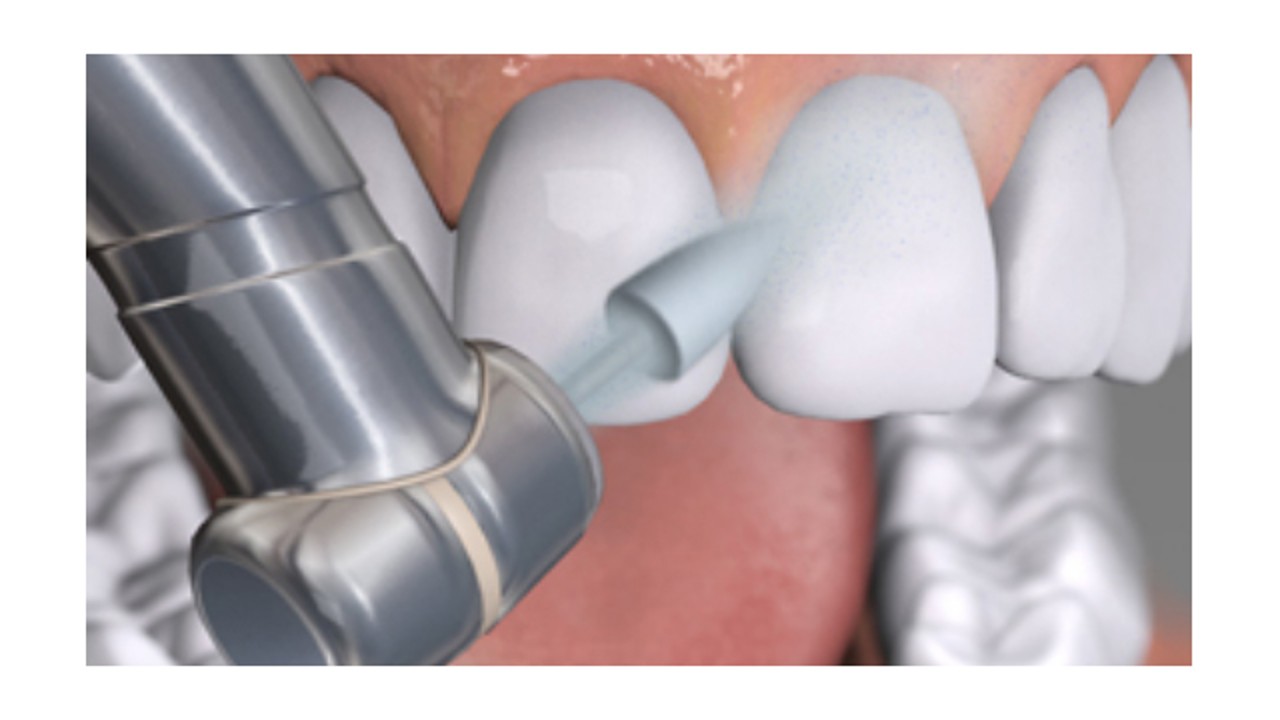 Υλικά αποκαταστάσεων