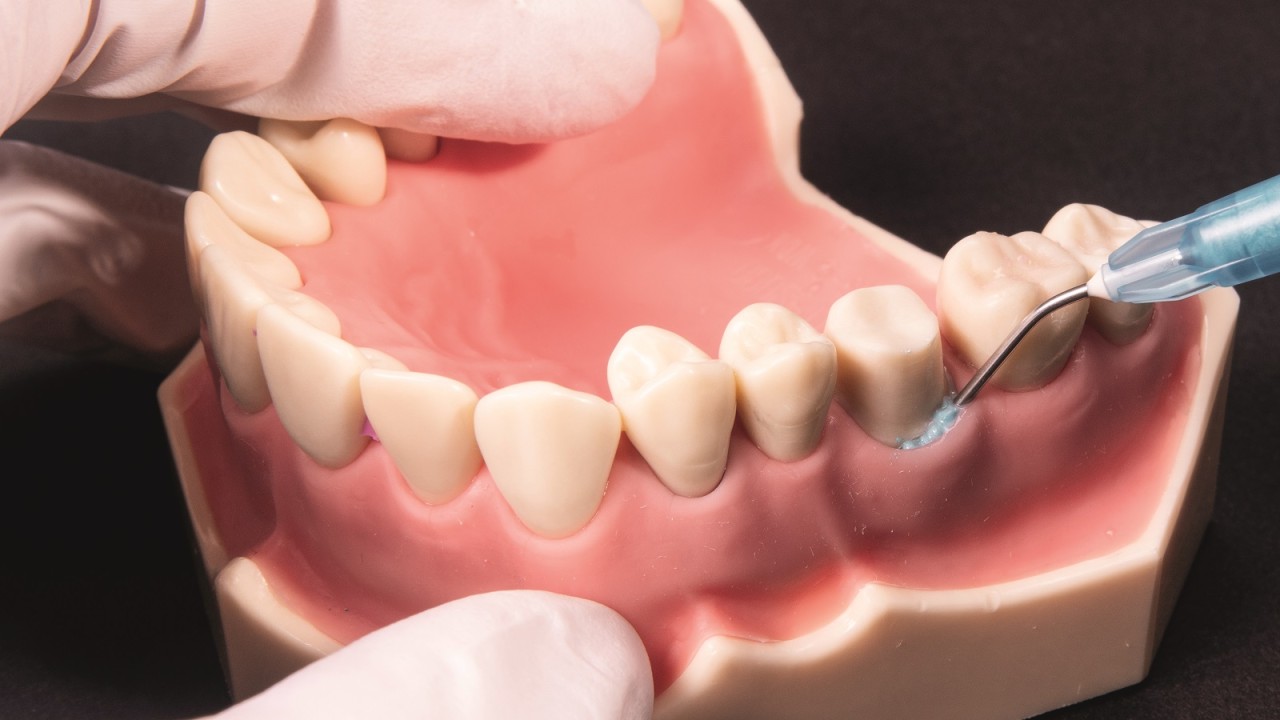 Soft Tissue Management