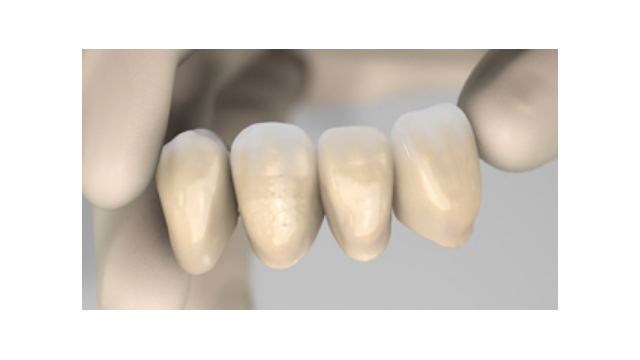 Υλικά Προσωρινών Εργασιών