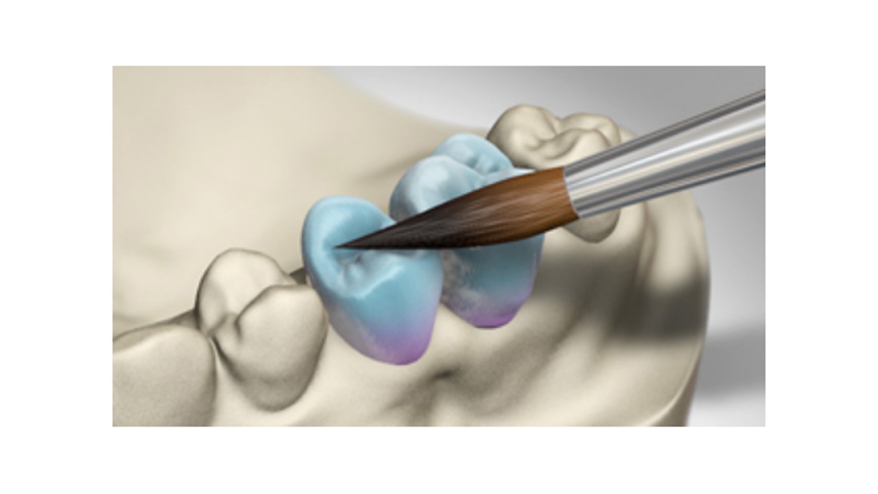 Κεραμικά επικάλυψης σκελετών