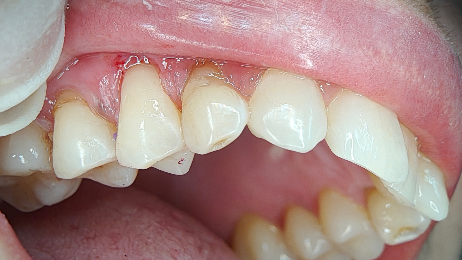 Click and hold the green slider. Move from side to side to reveal the before-and-after pictures.