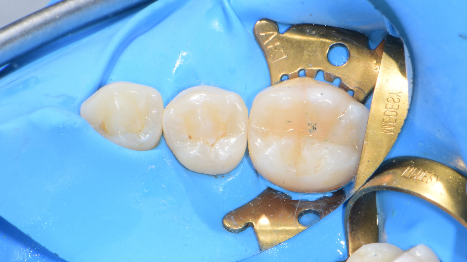 Click and hold the green slider. Move from side to side to reveal the before-and-after pictures.