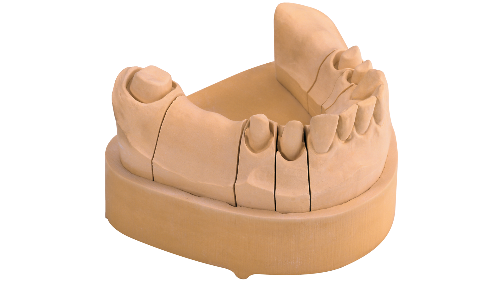 Οδοντιατρικές Γύψοι