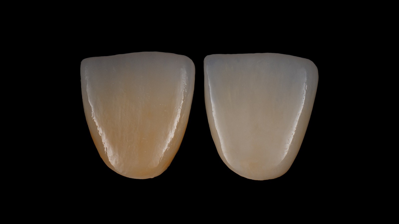 Απλά ενισχύστε της φωτεινότητας με το HeraCeram cre-active 2D EH Bright