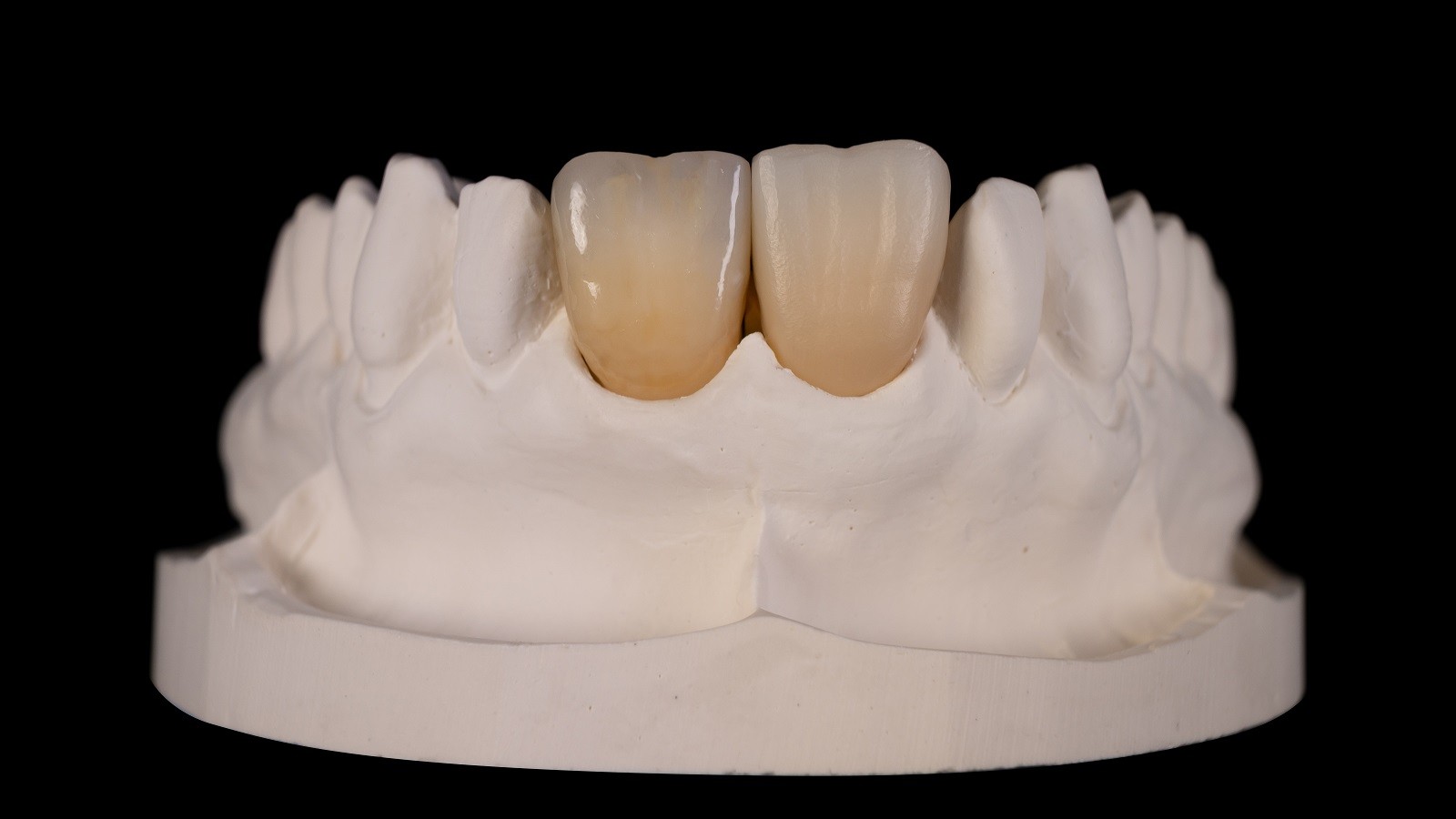 Τελικό αποτέλεσμα μετά την όπτηση του HeraCeram cre‑active 2D.