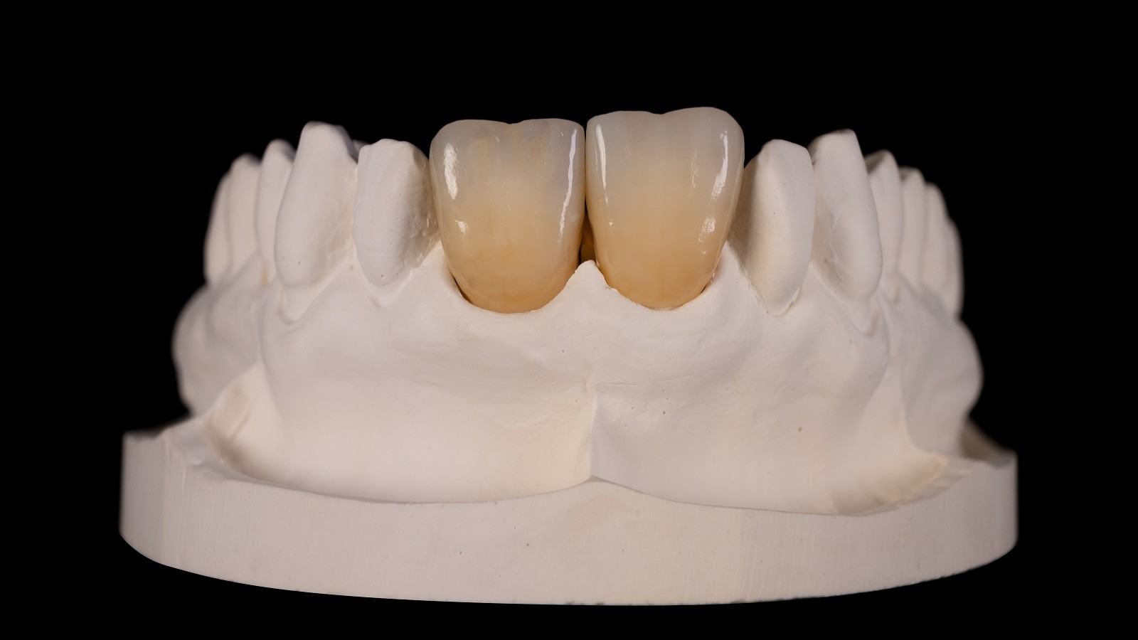 Links: individuell - rechts: standard Schichtung