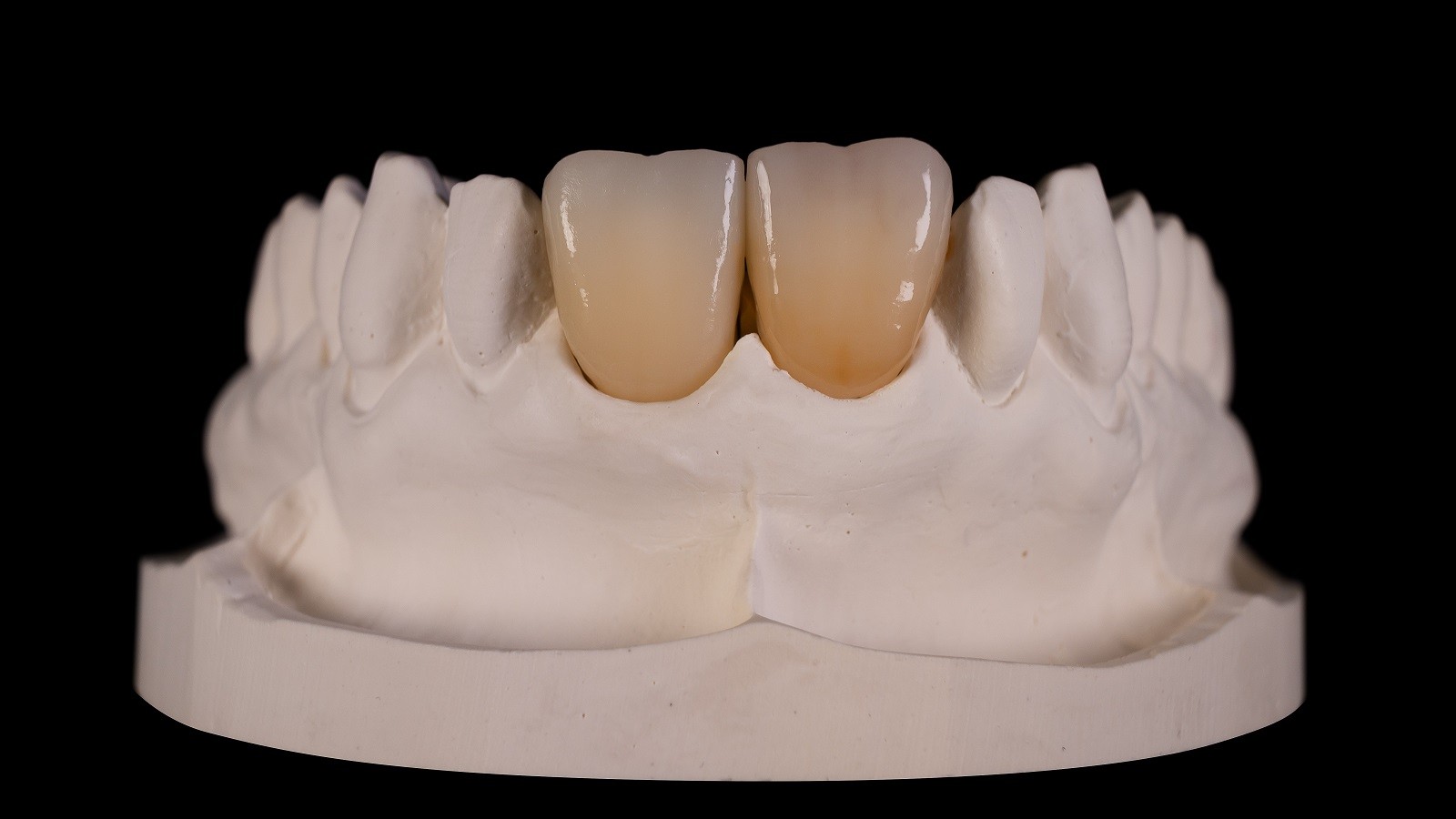 HeraCeram cre-active 2D Aubergine