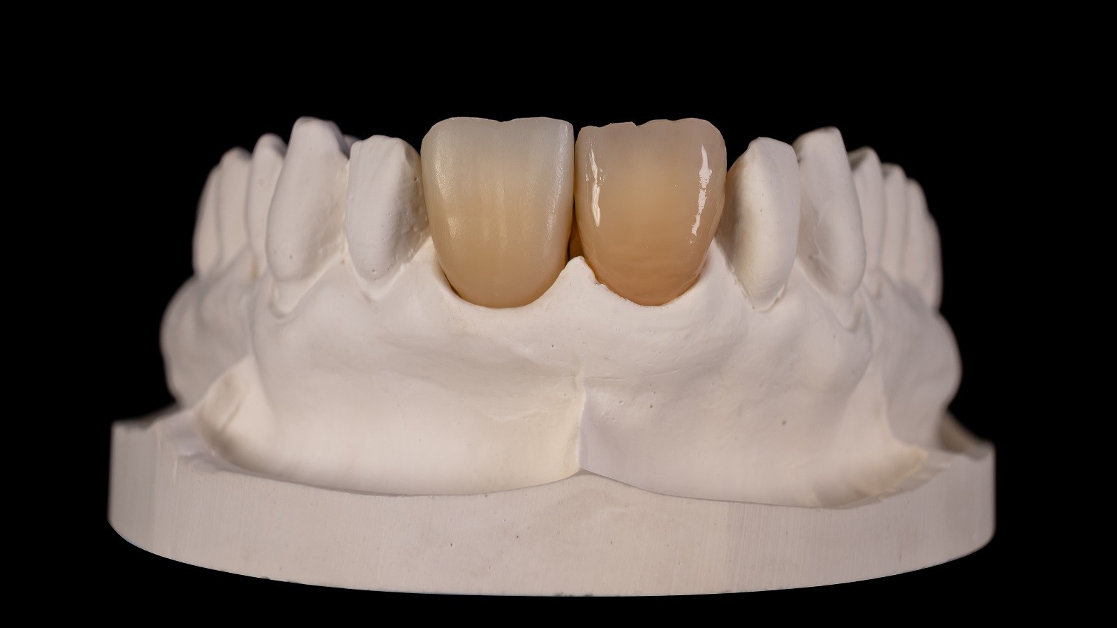 Apply a thin layer of HeraCeram cre-active Glaze Fluo over the entire surface