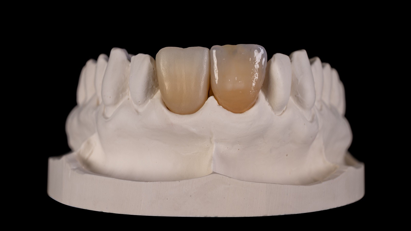 Result after HeraCeram cre-active 3D firing
