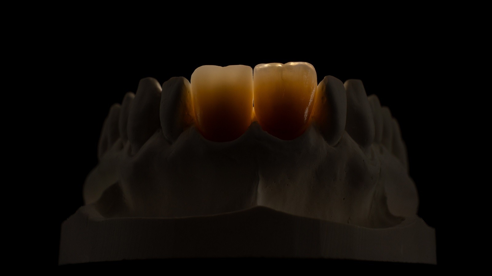 Σε διαπερατό φως.