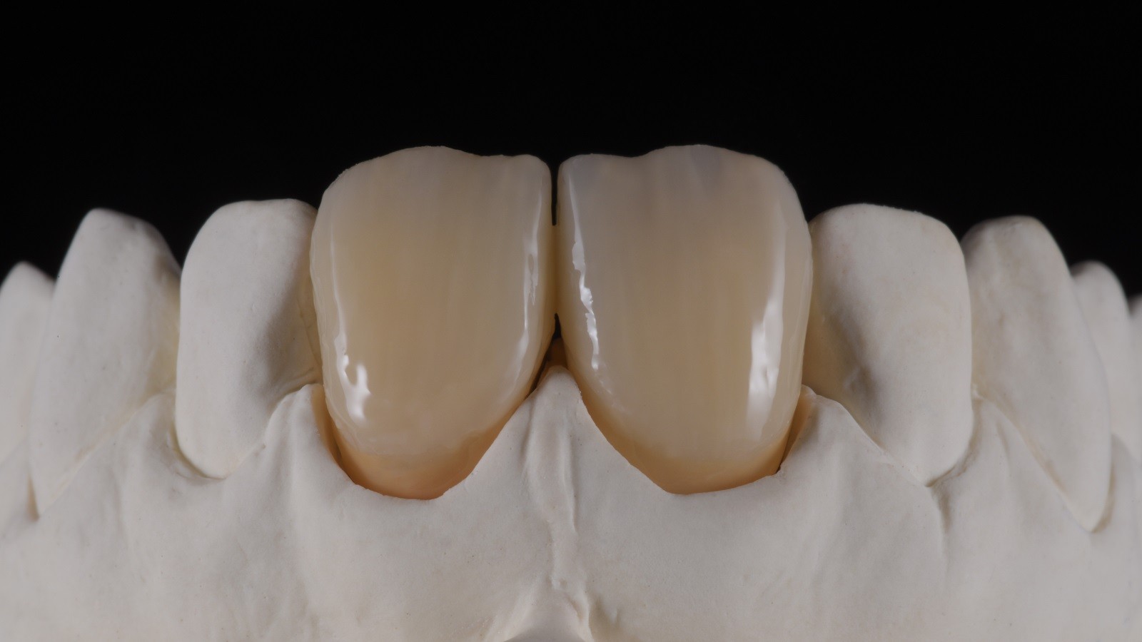 HeraCeram cre-active - take two concept