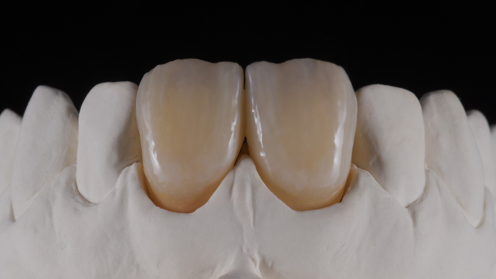 HeraCeram cre-active - take two concept